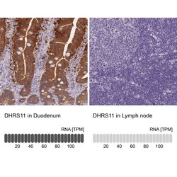 MGC4172 Antibody, Novus Biologicals 0.1mL; Unlabeled:Antibodies, Polyclonal